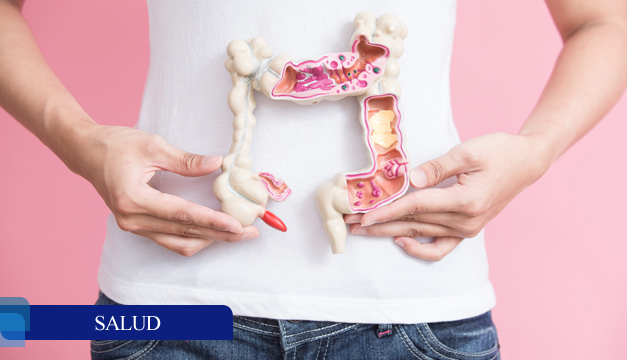 ¿El colon irritable puede convertirse en cáncer? Conoce más sobre la