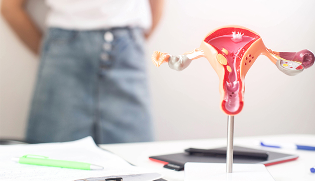 ¿Qué es el síndrome de ovario poliquístico?